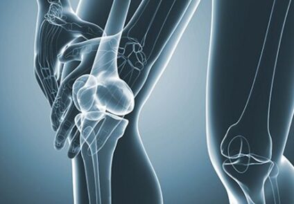 Myths and Facts About Orthopaedic Surgery